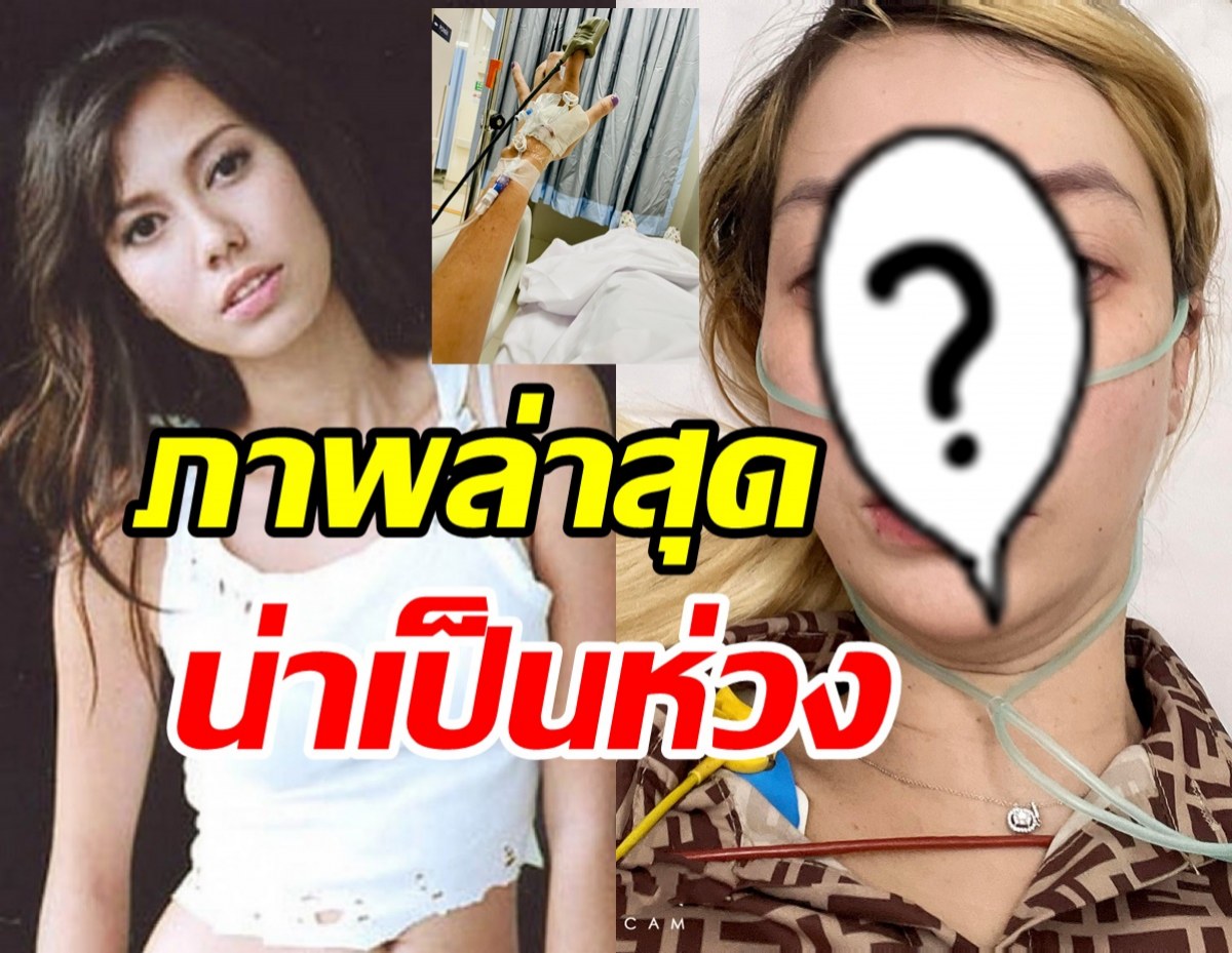 เปิดภาพล่าสุดอดีตนางแบบดัง โอเด็ต ป่วยเข้ารพ.ต้องใส่สายออกซิเจน