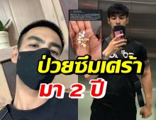 นักแสดงหนุ่ม เผยประสบการณ์ป่วยโรคซึมเศร้า อย่ากลัว-รักษาหายได้