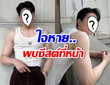 พระเอกหน้าหวาน ผ่าตัดซีสต์ที่หน้า โชคดีไม่ใช่เนื้อร้าย