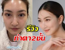  ธรรมชาติสุดๆ แพนเค้ก เล่าความลับเบื้องหลังการทำตา2ชั้นแบบจัดเต็ม