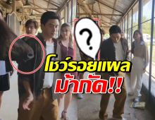 เห็นแล้วตกใจ! เปิดแผล ป๋อ ณัฐวุฒิ โดนม้ากัดกลางรายการ