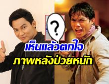 ภาพล่าสุด จา พนม หลังป่วยมะเร็งถุงน้ำดี ระยะ 3 เกือบ 4