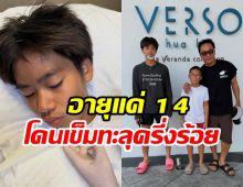 สปิริตสุดยอด! น้องออก้า คางแตกแต่ใจสู้แข่งเจ็ตสกีต่อ