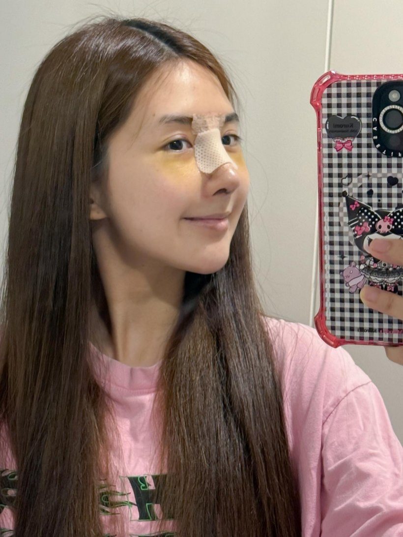 ชาวเน็ตมีทึ่ง!! เบียร์ เดอะวอยซ์ ทำจมูกใหม่ สวยออร่ากว่าเดิม