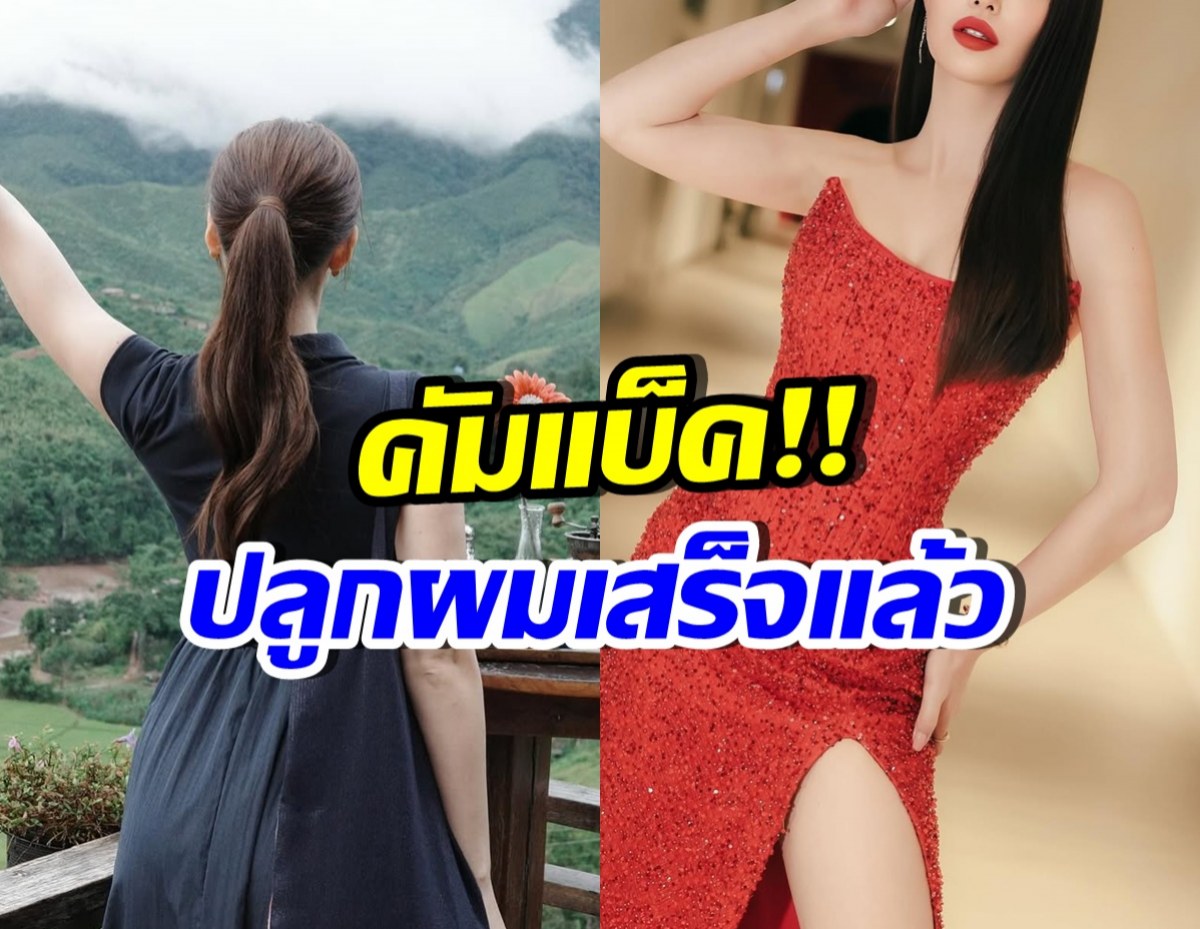 ไม่ได้หายไปไหน! เธอคนนี้ กลับมารับงานรัวๆ หลังปลูกผม