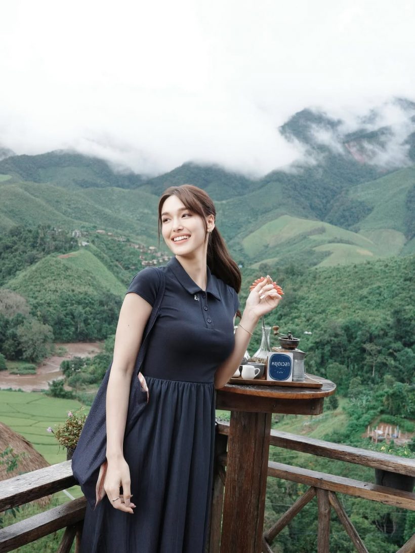 ไม่ได้หายไปไหน! เธอคนนี้ กลับมารับงานรัวๆ หลังปลูกผม