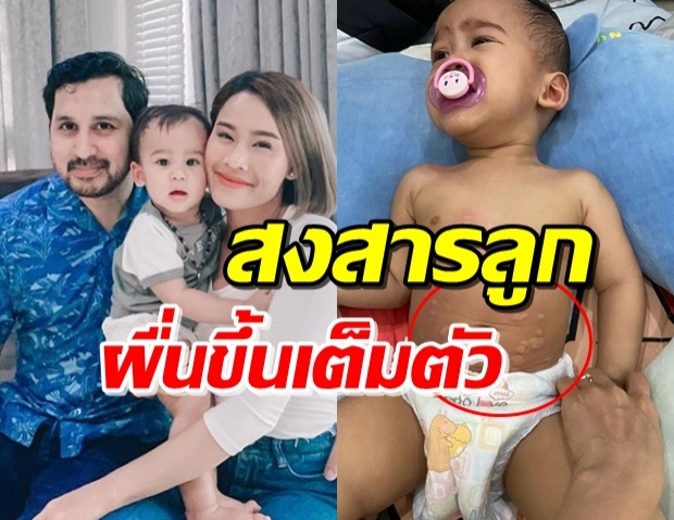 ‘หนูเล็ก’ เผย ‘น้องวิน’ กินไก่ทอด คนขายรู้ไม่จริงทำเกิดอาการแพ้!