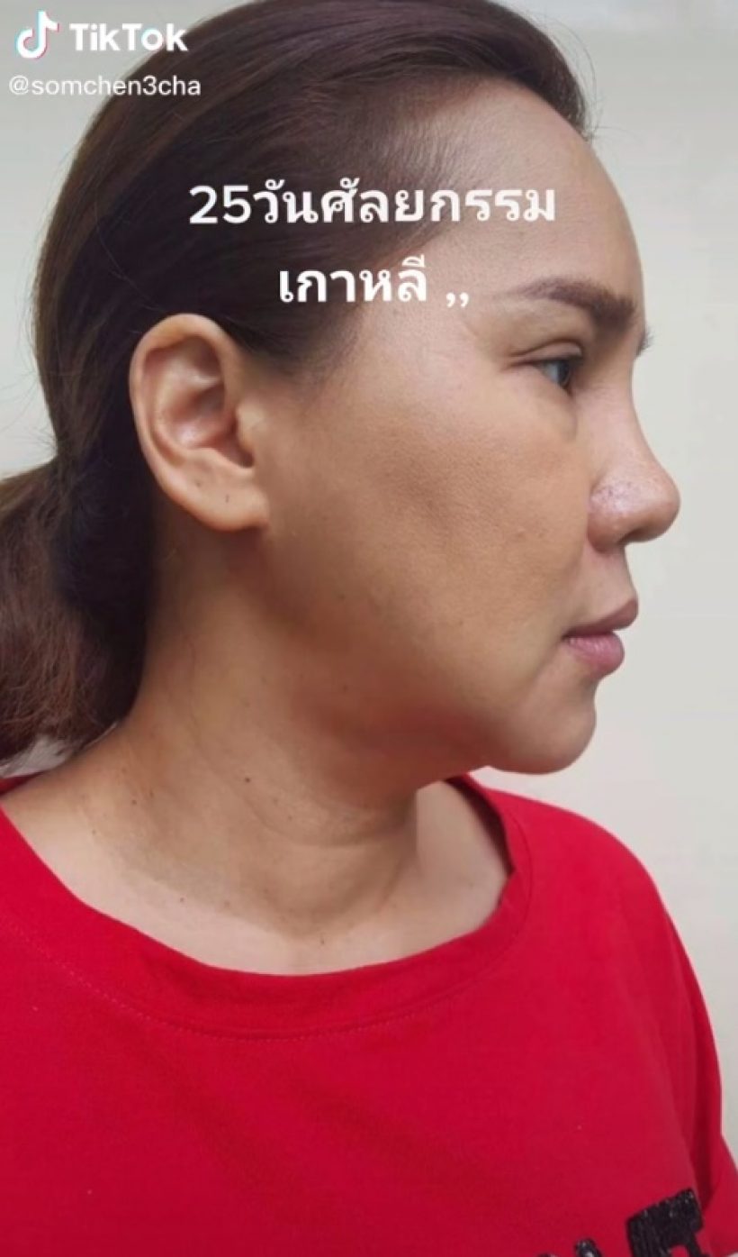   เปิดหน้าใหม่ ส้มเช้ง สามช่า ทุ่มไปเกือบ4แสนคุ้มมั้ย-ทำอะไรบ้าง?