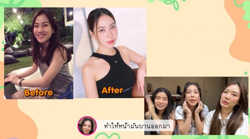 ก้อย-นัตตี้-ดรีม เปิดหมดไม่กั๊ก หน้าสวยปิ๊งแบบนี้ศัลย์อะไรบ้าง