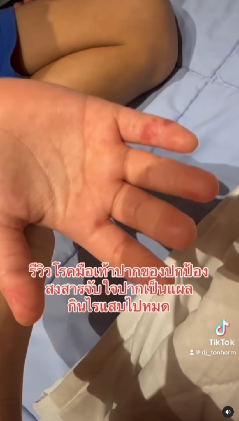 แห่เป็นห่วง น้องปกป้อง หลังดีเจต้นหอมรีวิว ลูกป่วยโรคนี้?