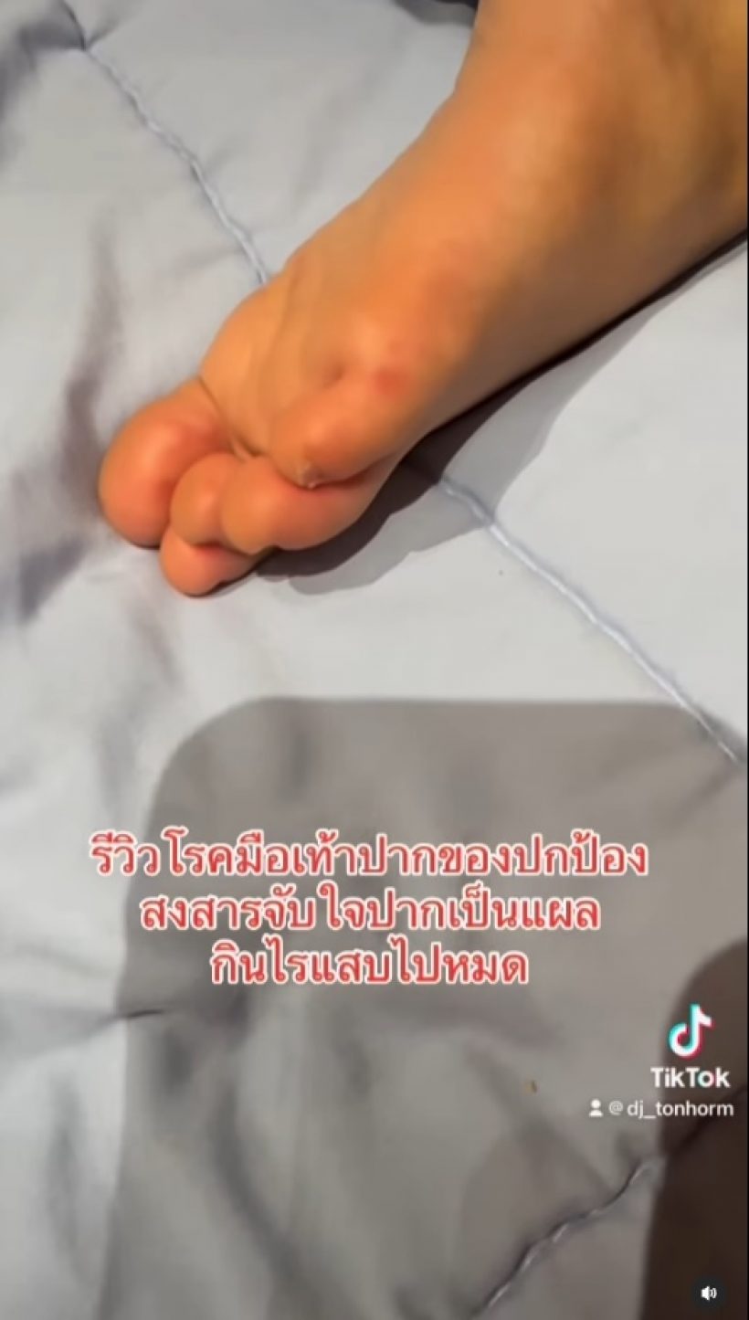 แห่เป็นห่วง น้องปกป้อง หลังดีเจต้นหอมรีวิว ลูกป่วยโรคนี้?