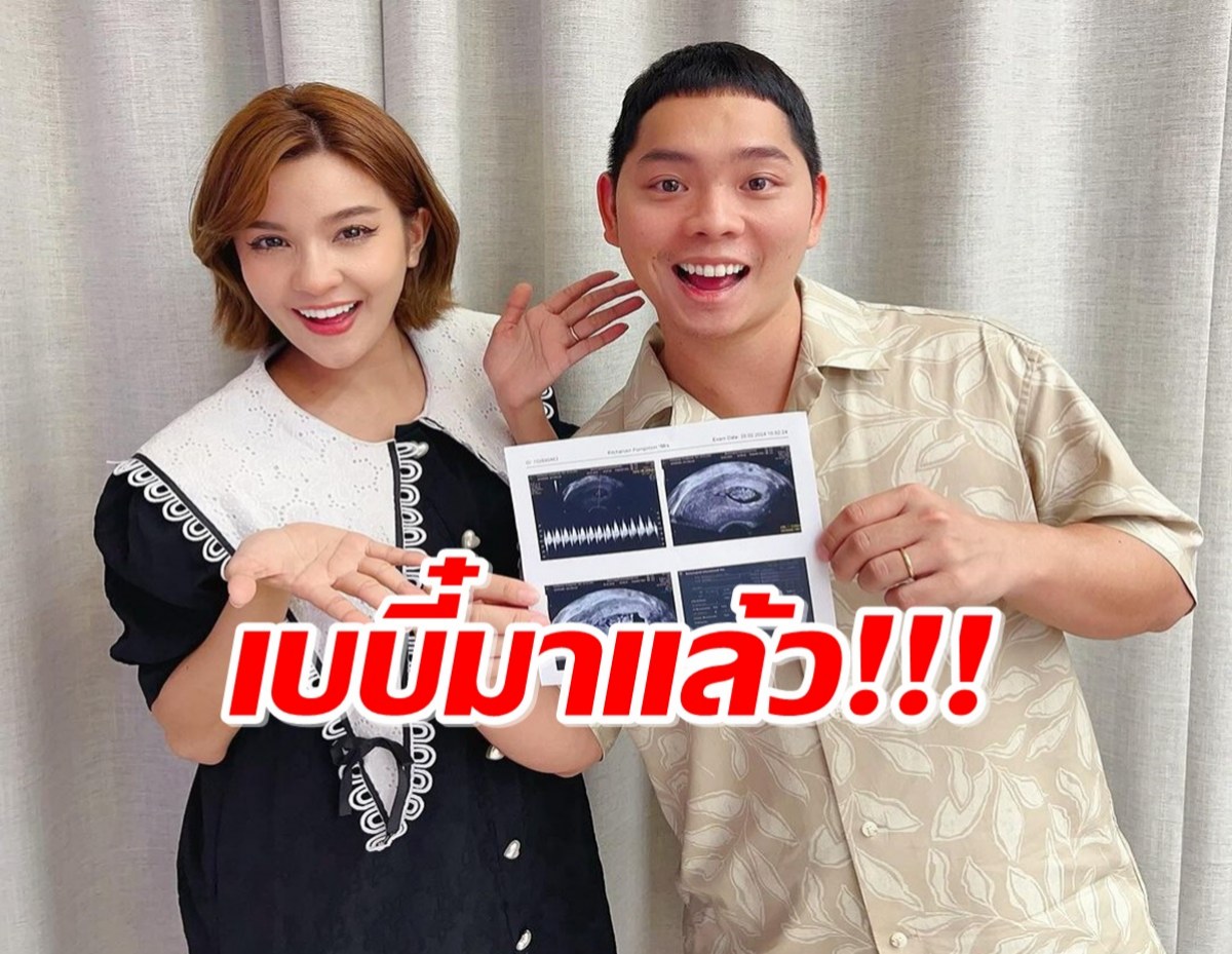 ยินดีด้วยจ้า เปา-เอิร์ท เบบี๋คนแรกมาแล้ว