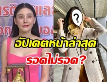 สุดปัง! แตงโม อวดภาพล่าสุด จากหน้าผิดรูป ตอนนี้เป็นไงบ้าง?