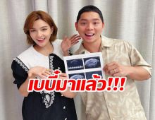 ยินดีด้วยจ้า เปา-เอิร์ท เบบี๋คนแรกมาแล้ว