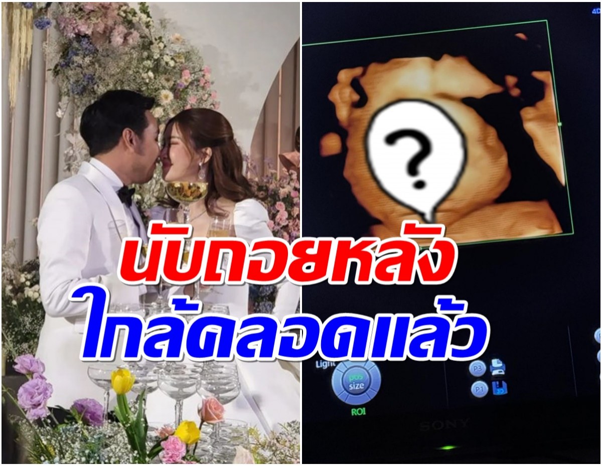 นักร้องสาวโชว์ภาพลูกน้อยในท้อง หน้าเหมือนใครมาดู