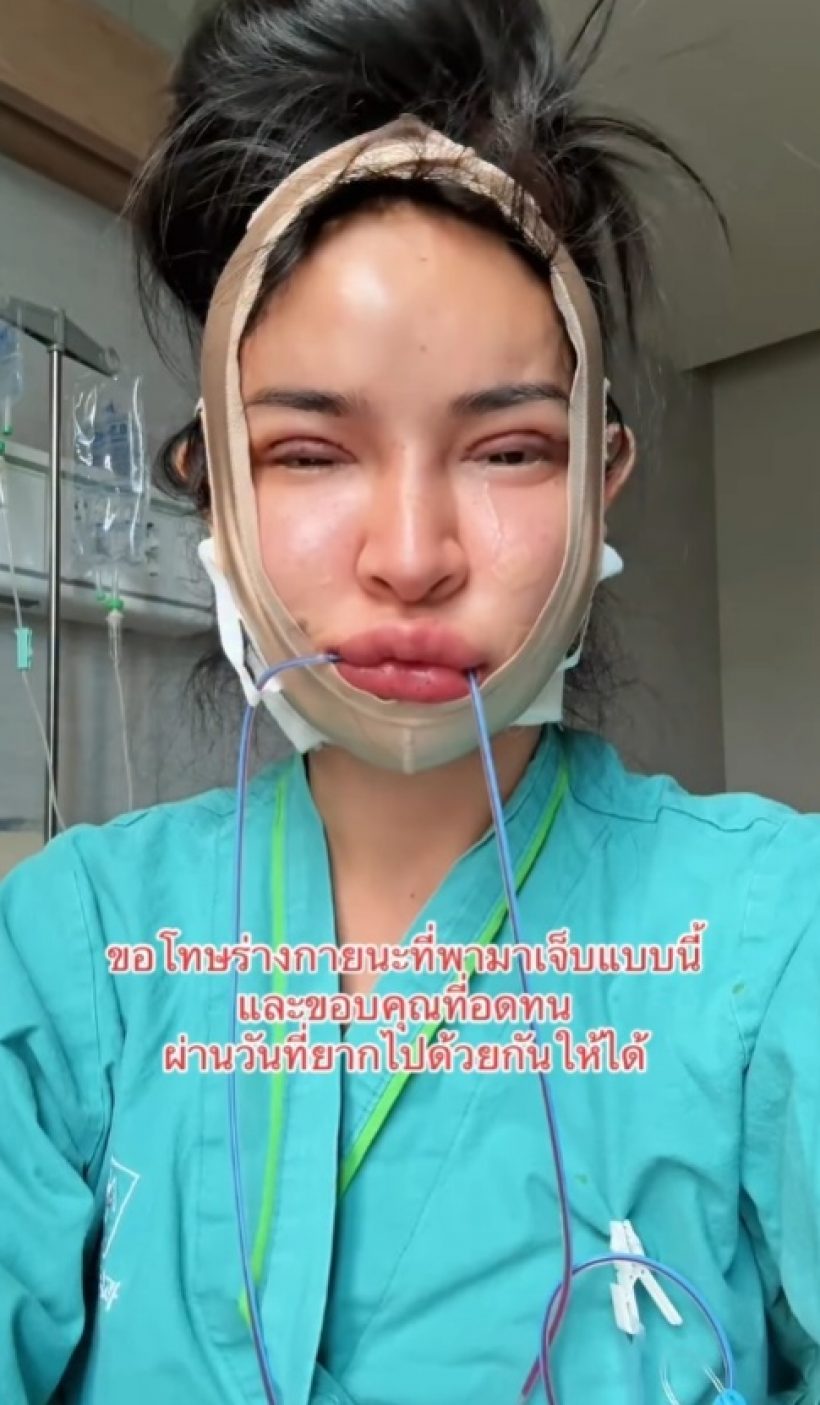 หน้าล่าสุด นัท นิสามณี หลังผ่าครั้งใหญ่ในชีวิต หวานใจดูแลไม่ห่าง
