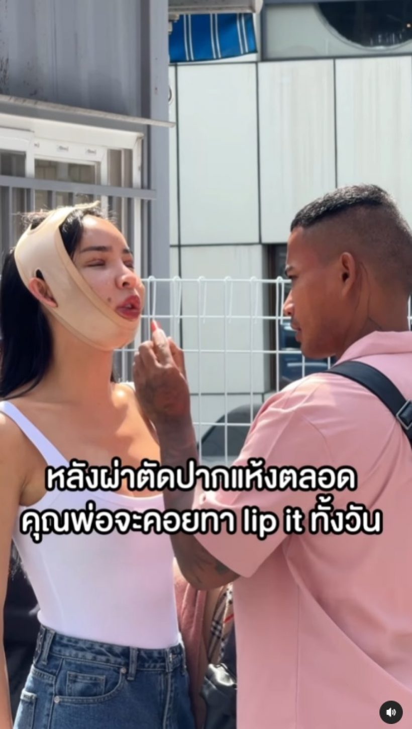 หน้าล่าสุด นัท นิสามณี หลังผ่าครั้งใหญ่ในชีวิต หวานใจดูแลไม่ห่าง