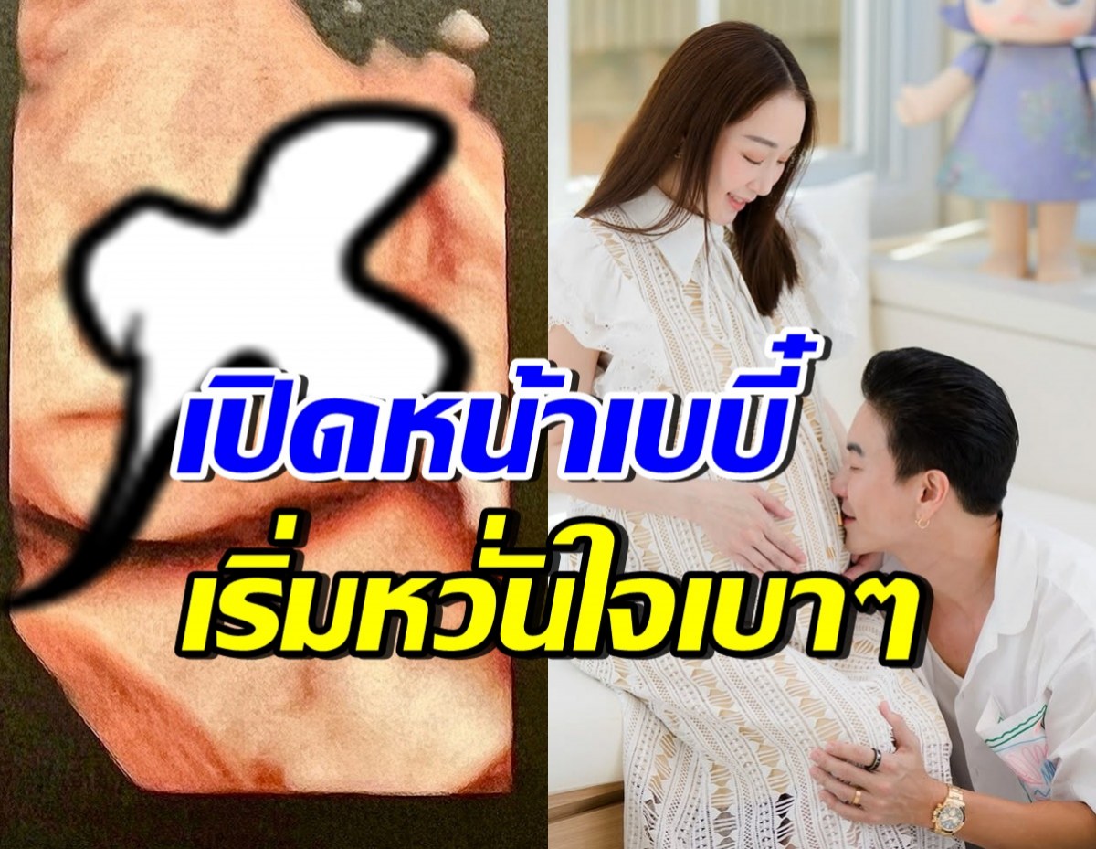 ตู่ ปิยวดี เผยภาพอัลตร้าซาวด์ ทายาทหมื่นล้าน ลั่นเริ่มหวั่นใจ!?