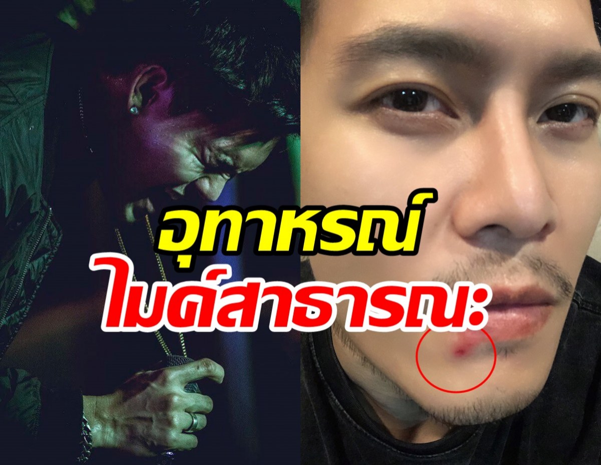 ดิว ภัทรพล ออกโรงเตือน! เหตุเกิดเพราะใช้ไมค์สาธารณะ