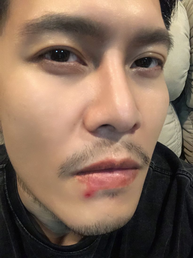 ดิว ภัทรพล ออกโรงเตือน! เหตุเกิดเพราะใช้ไมค์สาธารณะ