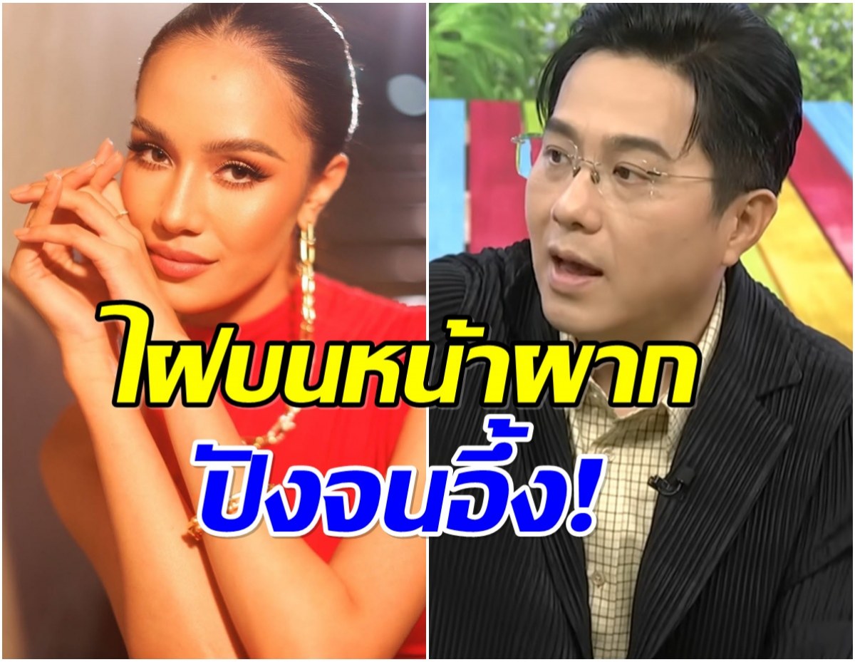 หมอช้างผ่าดวง โอปอล Miss World ทั้งเเก้มทั้งไฝ ปังจนน่าตะลึง