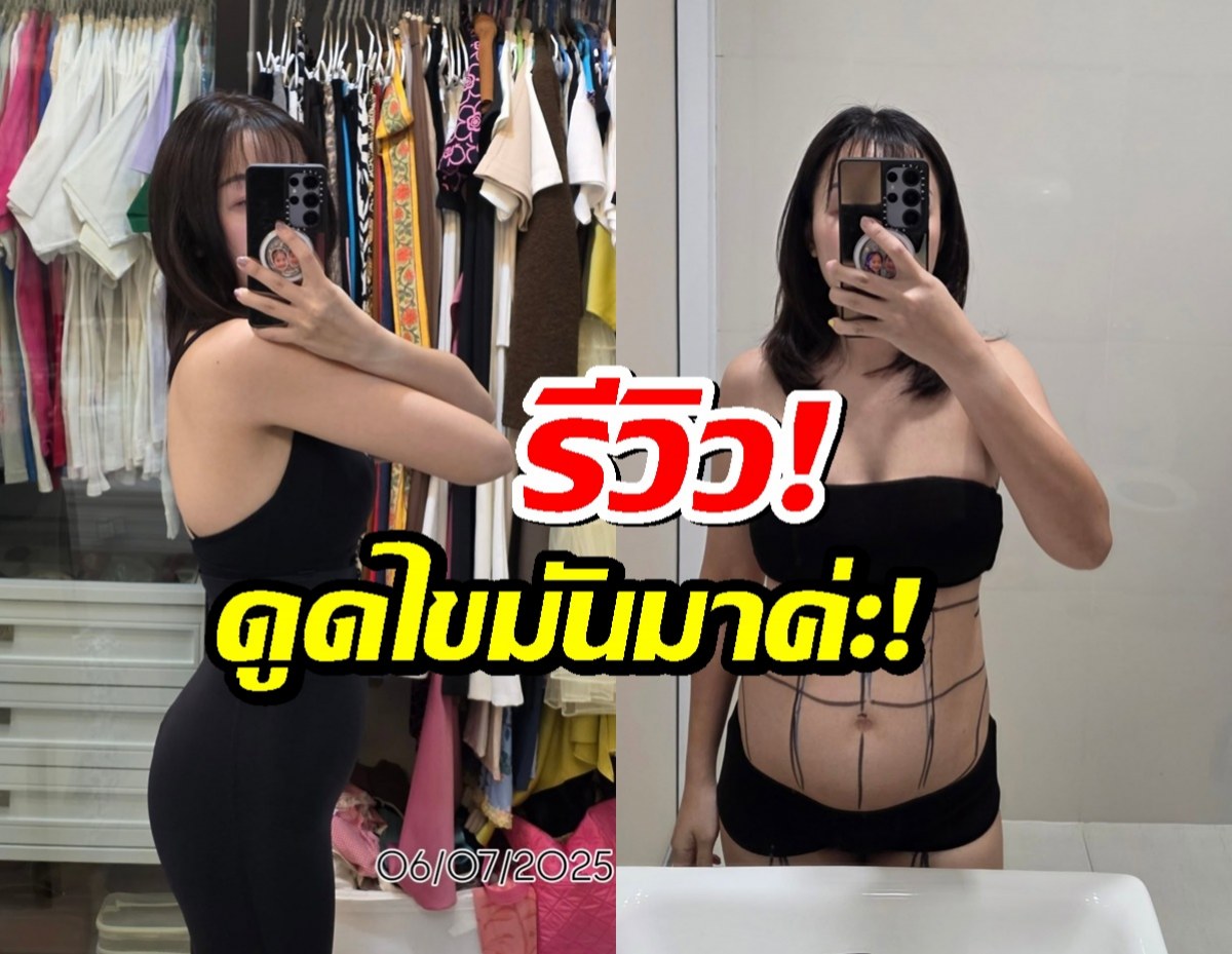 สาวคนดัง ยอมรับ ดูดไขมันมาค่ะ