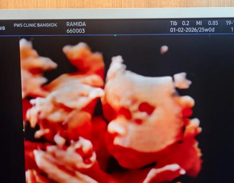 ดาราสาวชื่อดัง เผยภาพอัลตร้าซาวด์ลูกรัก หลังรอมานานนับปี