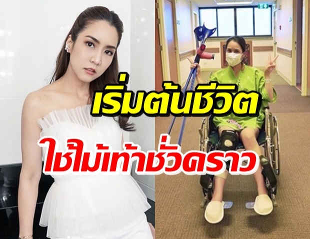 เจ็บแปล๊บๆ! จั๊กจั่น ผ่าตัดหัวเข่าแล้ว เตรียมทำกายภาพบำบัด