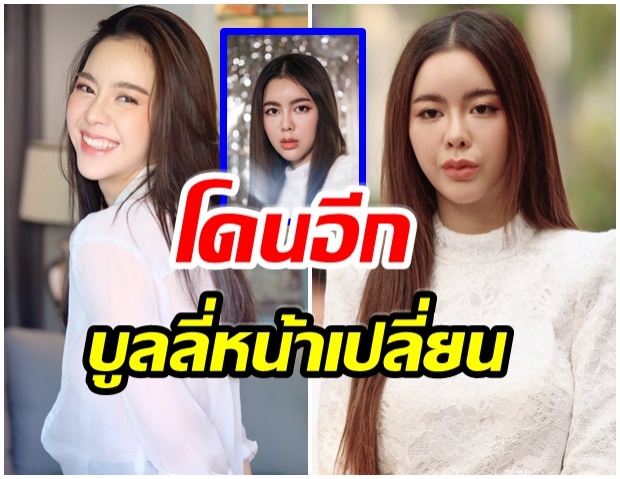 ไอซ์ ปรีชญา โดนบูลลี่หน้าเปลี่ยน-เสพติดการศัลยกรรม 