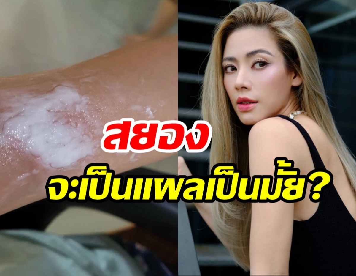 เอ๋ พรทิพย์ เกิดอุบัติเหตุพาลูกไปลอยกระทง สุดท้ายนั่งซับน้ำตา