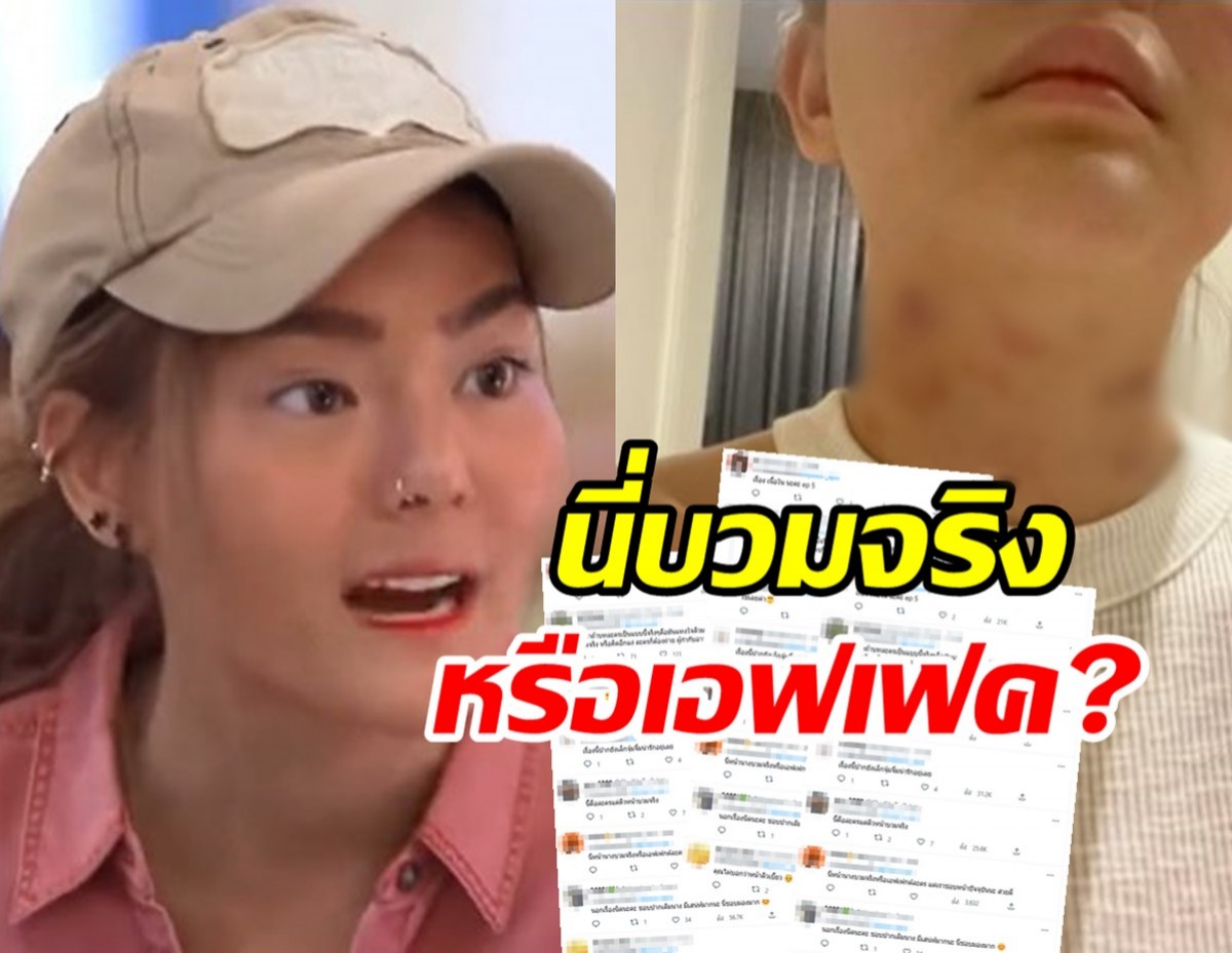  ชาวเน็ตขุด!!ดิวเล่นละครฟกช้ำทั้งตัว คนมองของจริงหรือเอฟเฟค?