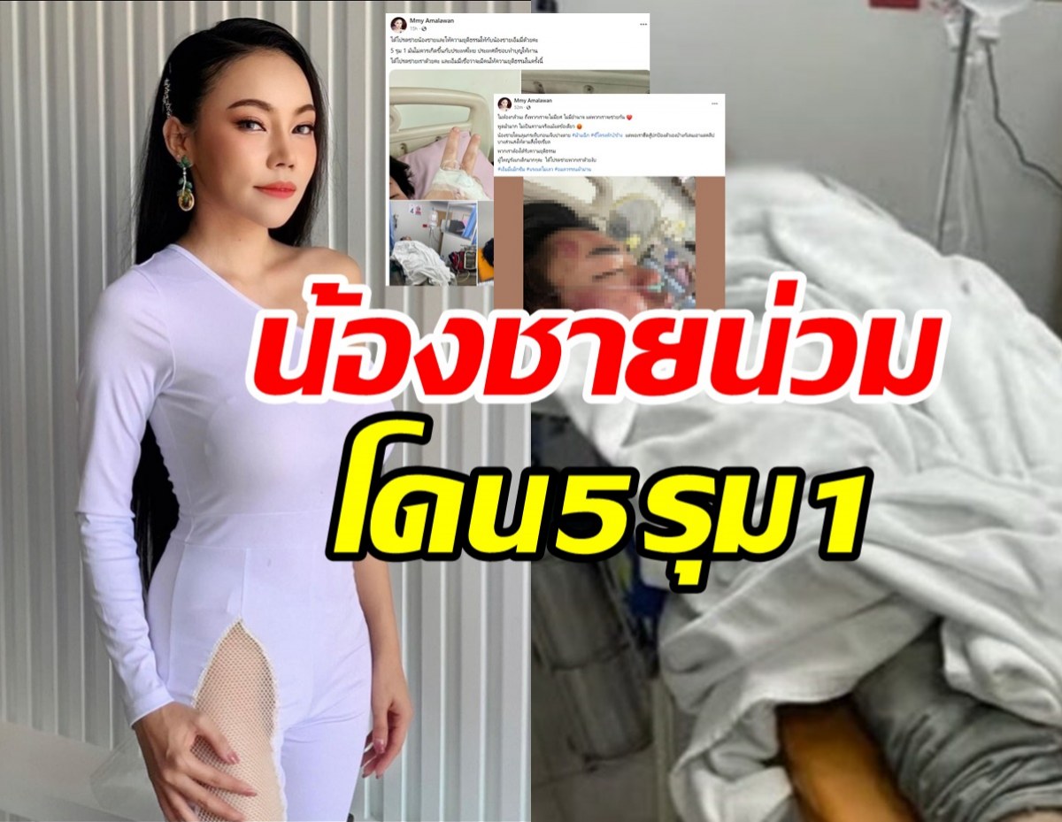 เอ็มมี่ แม็กซิม เผยสภาพน้องชายโดน5รุม1ลั่นต้องได้รับความยุติธรรม 