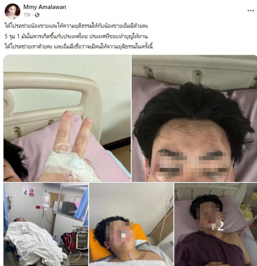 เอ็มมี่ แม็กซิม เผยสภาพน้องชายโดน5รุม1ลั่นต้องได้รับความยุติธรรม 