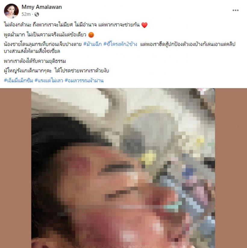 เอ็มมี่ แม็กซิม เผยสภาพน้องชายโดน5รุม1ลั่นต้องได้รับความยุติธรรม 