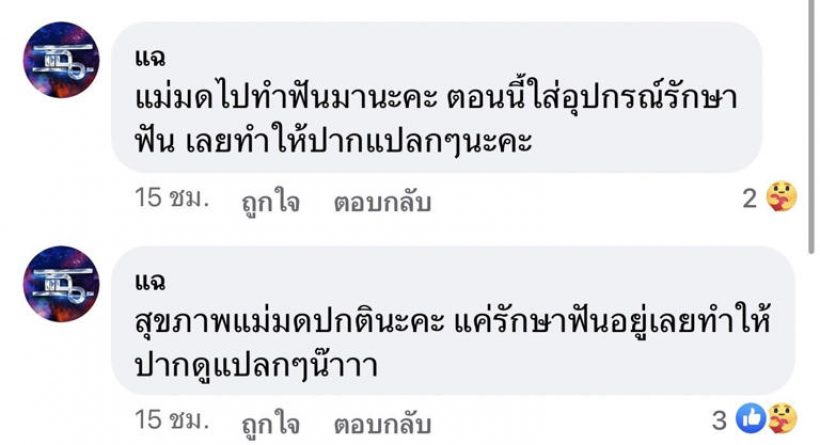 แห่เป็นห่วง มดดำ อ่านข่าวปากเบี้ยว-เจ้าตัวแจงเกือบขิตแล้ว!!