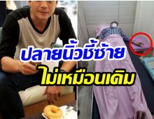 อดีตนักเเสดงช่อง7 ตัดพ้อ! ต้องผ่าตัดนิ้วชี้4ครั้ง-หายมาอาจไม่เหมือนเดิม