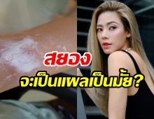 เอ๋ พรทิพย์ เกิดอุบัติเหตุพาลูกไปลอยกระทง สุดท้ายนั่งซับน้ำตา