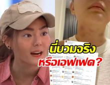  ชาวเน็ตขุด!!ดิวเล่นละครฟกช้ำทั้งตัว คนมองของจริงหรือเอฟเฟค?