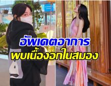 สาวคนดังเล่ามรสุมชีวิต พบเนื้องอกในสมอง 6 เซนติเมตร