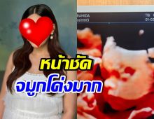 ดาราสาวชื่อดัง เผยภาพอัลตร้าซาวด์ลูกรัก หลังรอมานานนับปี