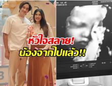 ใจสลาย! นุ่น-หลุยส์ เตรียมเเถลงข่าวใหญ่ สูญเสียลูกในครรภ์