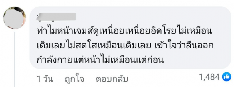 ชาวเน็ตทัก เจมส์ จิรายุ ไปทำอะไรมาหน้าไม่เหมือนเมื่อก่อน