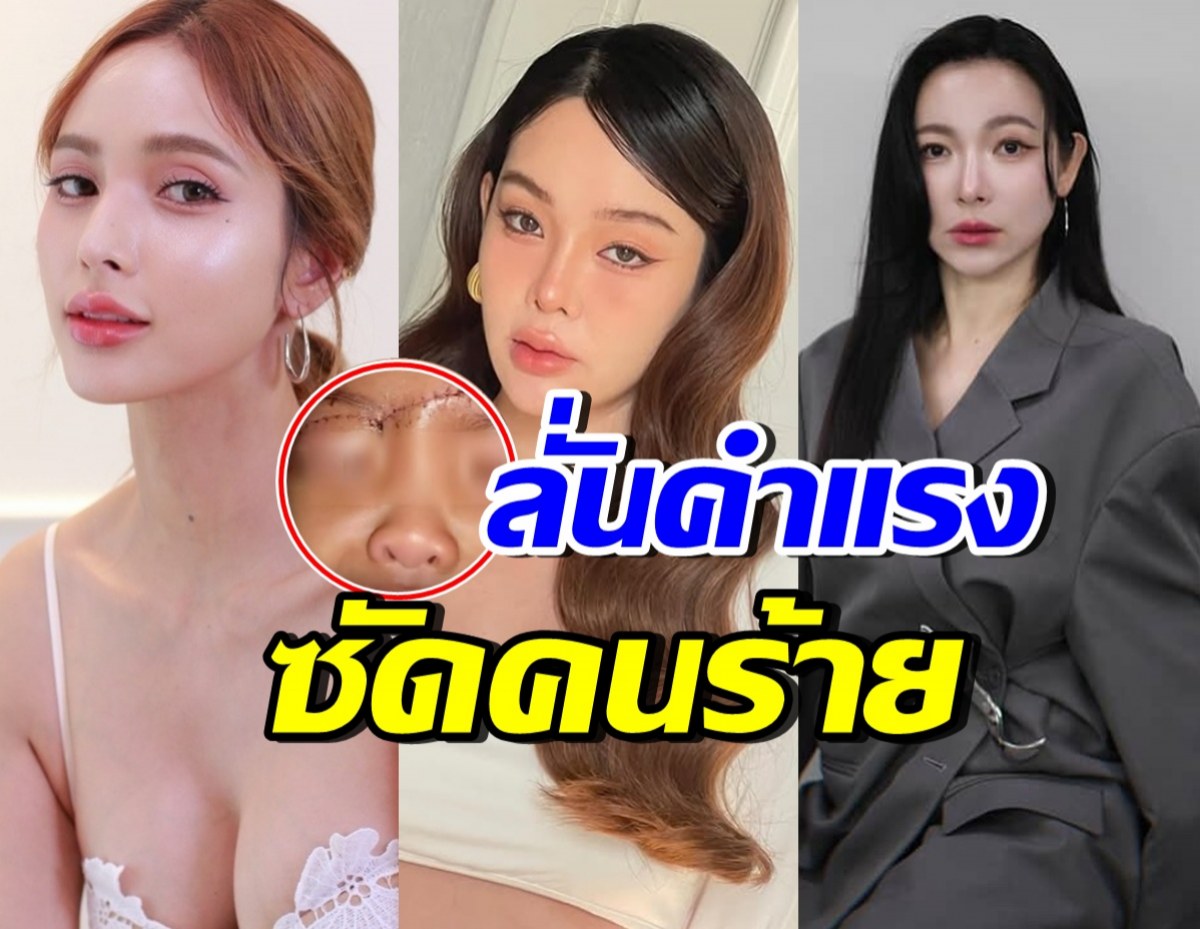 เหล่าคนบันเทิง เดือดมาก!! ด่าคนร้าย เด็ก4ขวบเป็นเหยื่อ ฟันผิดตัว