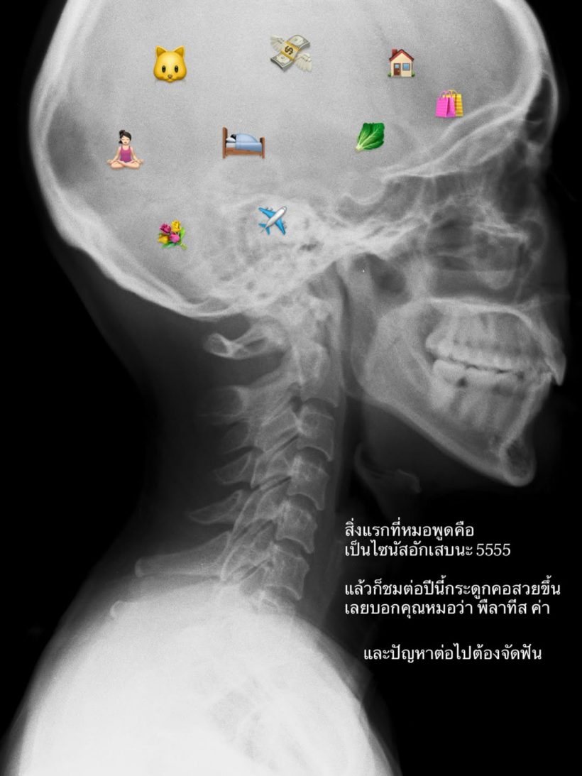 ดาราสาวดังยิ้มสวย แต่เจอปัญหาใหญ่ หมอสั่งต้องจัดฟัน