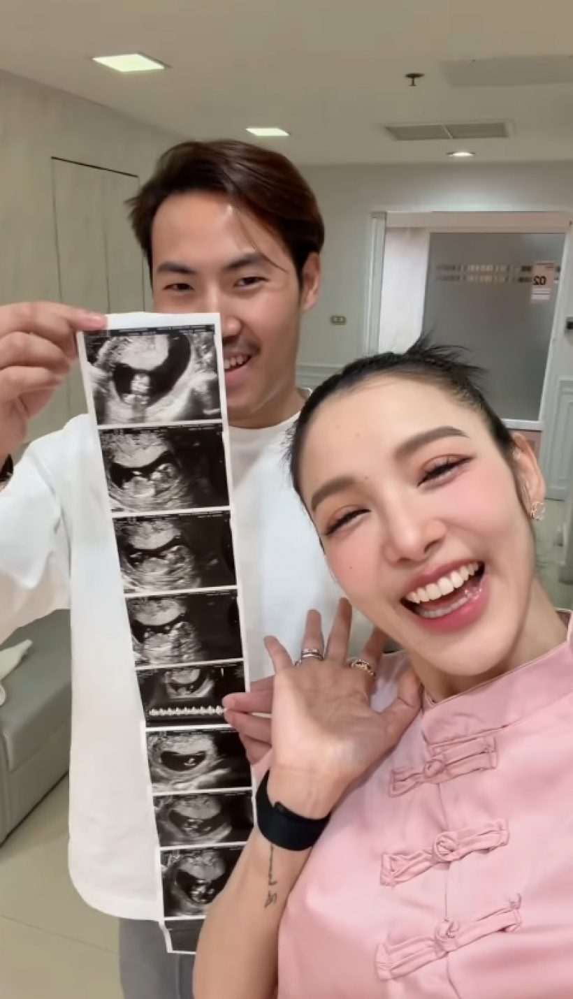 ข่าวดีมาแล้ว! เปิดภาพอัลตร้าซาวด์เบบี๋ในท้อง แพท ณปภา