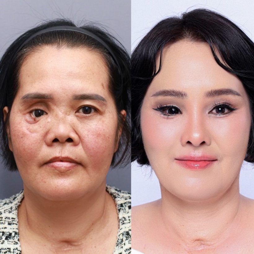 โซแบม เผยหน้าใหม่ของคุณแม่ ลบแผลใจที่ถูกบูลลี่