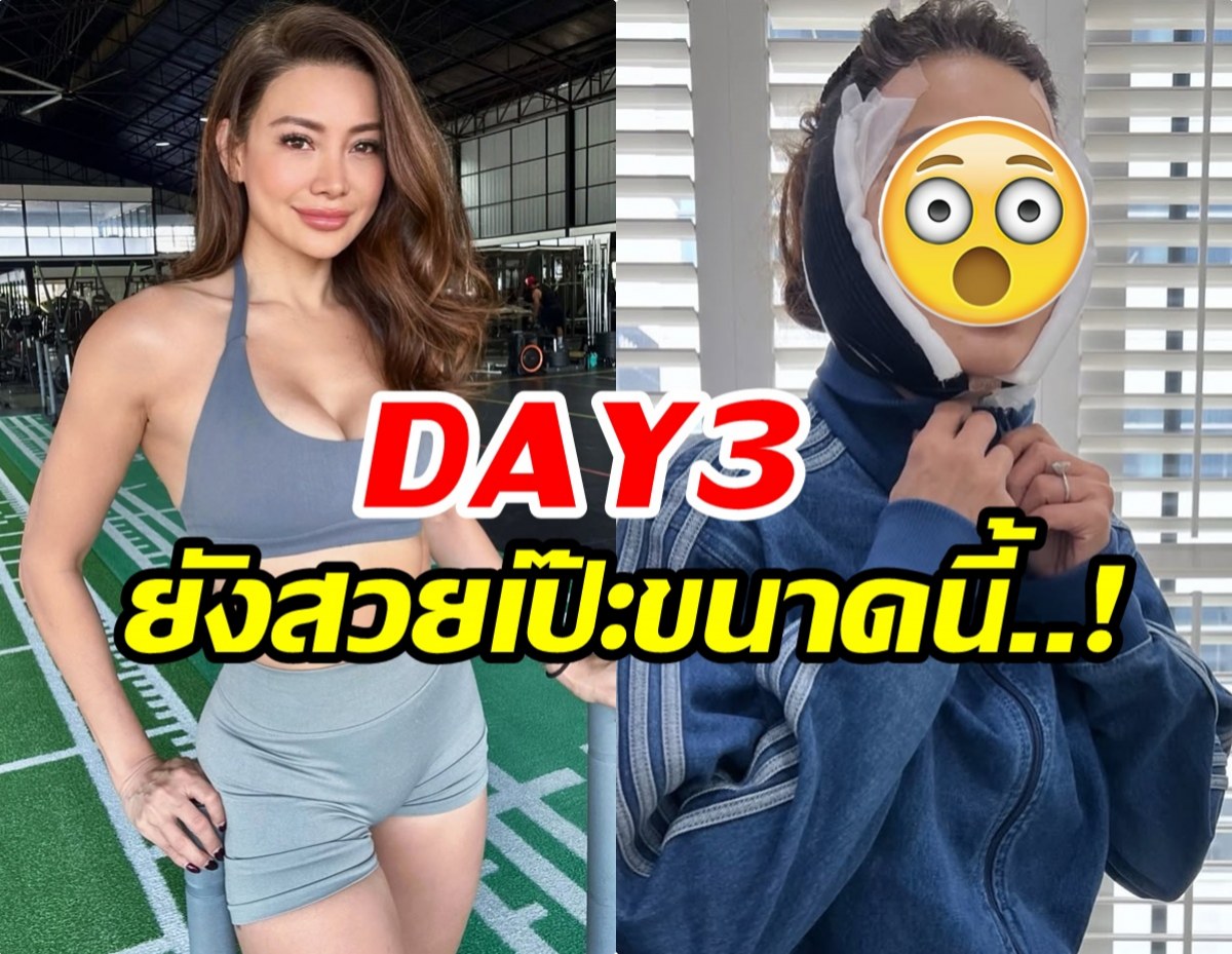 เปิดหมดไม่มีกั๊ก! โย ยศวดี เล่าประสบการณ์ดึงหน้า คุ้มค่าทุกบาท