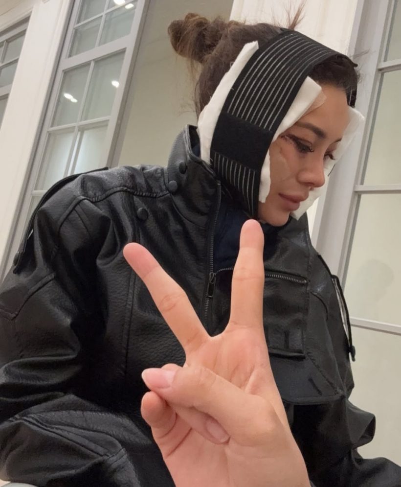 เปิดหมดไม่มีกั๊ก! โย ยศวดี เล่าประสบการณ์ดึงหน้า คุ้มค่าทุกบาท