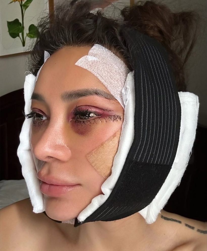 เปิดหมดไม่มีกั๊ก! โย ยศวดี เล่าประสบการณ์ดึงหน้า คุ้มค่าทุกบาท