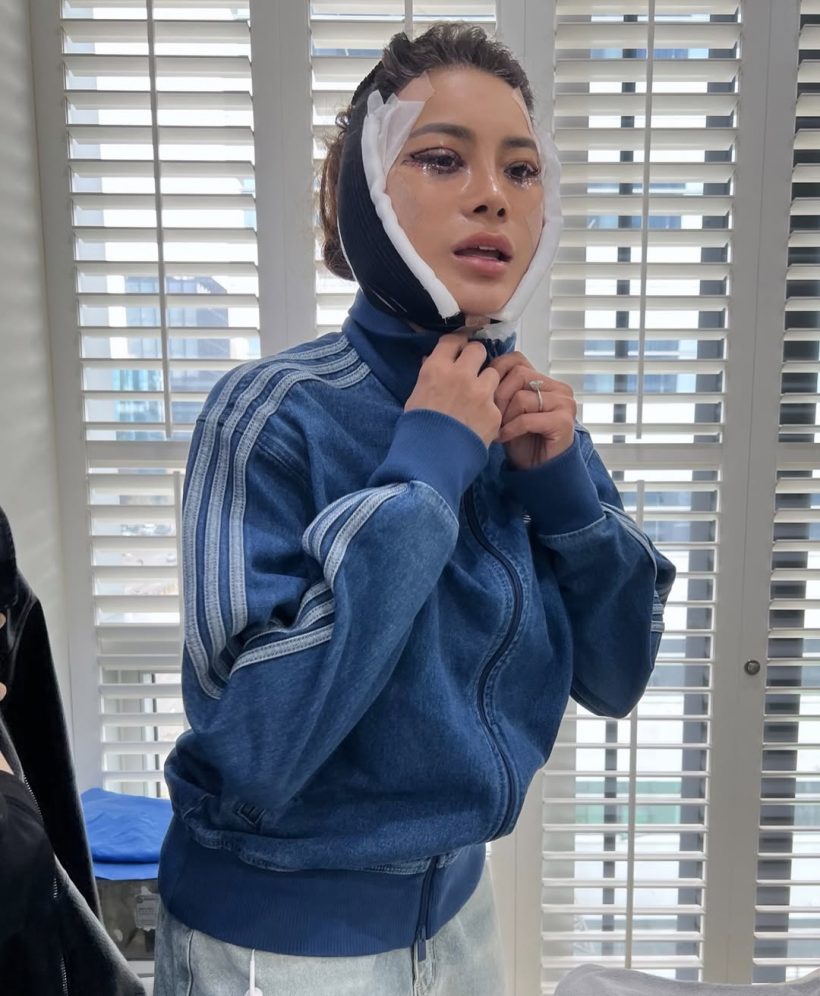 เปิดหมดไม่มีกั๊ก! โย ยศวดี เล่าประสบการณ์ดึงหน้า คุ้มค่าทุกบาท